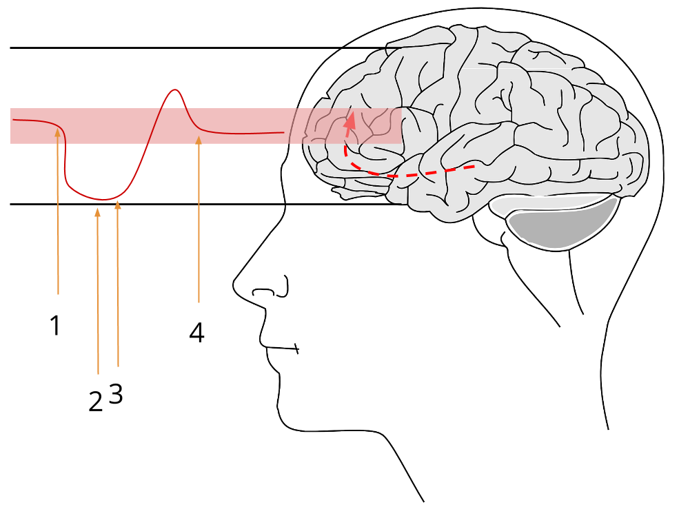 dopamine brain